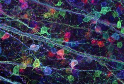 Brainbow.cropped_630